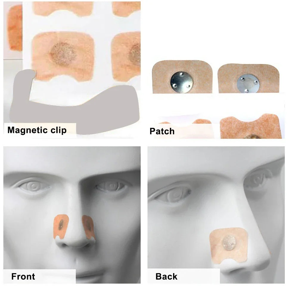 Nasal Airflow Enhancer 30 Day Magnet Re-fill 